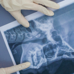 Como Imprimir Imagens Radiológicas em Papel Comum com Qualidade